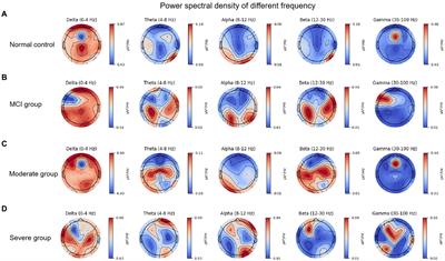 EEG biomarkers analysis in different cognitive impairment after stroke: an exploration study